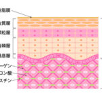 シワの解消のために